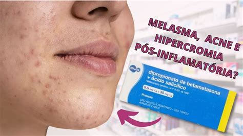 lotofácil 3064 - lotofacil 3064 postcode
